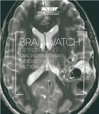 Detecting and Diagnosing Brain Diseases with Medical Imaging Table of Contents 3 Brainwatch Table of Contents