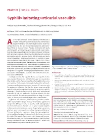 Syphilis Imitating Urticarial Vasculitis