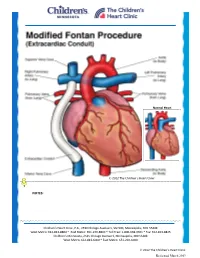 Modified Fontan Procedure: Extracardiac Conduit