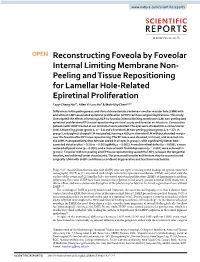 Reconstructing Foveola by Foveolar Internal Limiting Membrane Non