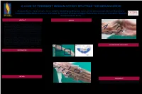 A Case of Persistent Median Artery Splitting