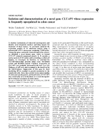Isolation and Characterization of a Novel Gene CLUAP1 Whose Expression Is Frequently Upregulated in Colon Cancer