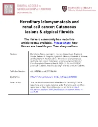 Atypical Fibroids