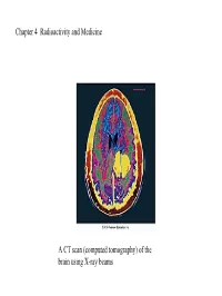 Chapter 4 Radioactivity and Medicine a CT Scan (Computed Tomography)