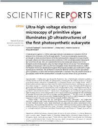 Ultra-High Voltage Electron Microscopy of Primitive Algae Illuminates 3D