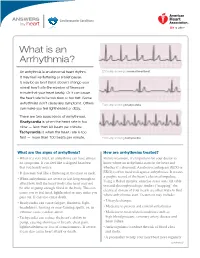 What Is an Arrhythmia?
