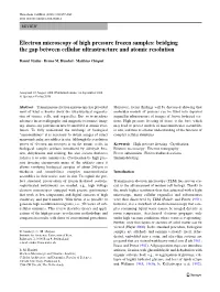 Electron Microscopy of High Pressure Frozen Samples: Bridging the Gap Between Cellular Ultrastructure and Atomic Resolution