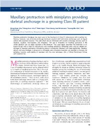 Maxillary Protraction with Miniplates Providing Skeletal Anchorage in a Growing Class III Patient