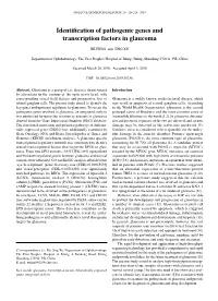 Identification of Pathogenic Genes and Transcription Factors in Glaucoma