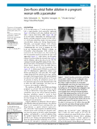 Zero-Fluoro Atrial Flutter Ablation in a Pregnant Woman with a Pacemaker