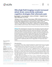 Ultra-High-Field Imaging Reveals Increased Whole Brain Connectivity