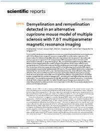 Demyelination and Remyelination Detected in an Alternative Cuprizone