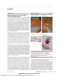 Elemental Composition of Ora Serrata Pearls—A Form of Focal Nodular