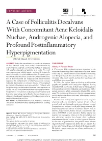 A Case of Folliculitis Decalvans with Concomitant Acne Keloidalis