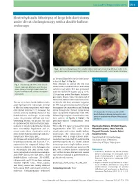 Electrohydraulic Lithotripsy of Large Bile Duct Stones Under Direct Cholangioscopy with a Double-Balloon Endoscope