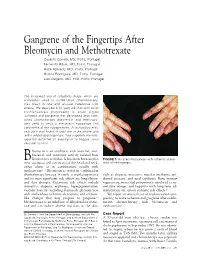 Gangrene of the Fingertips After Bleomycin and Methotrexate