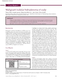 Malignant Nodular Hidradenoma of Scalp