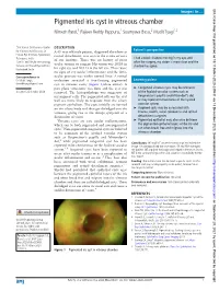 Pigmented Iris Cyst in Vitreous Chamber Nimesh Patel,1 Rajeev Reddy Pappuru,1 Soumyava Basu,2 Mudit Tyagi1,2