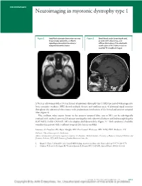 Neuroimaging in Myotonic Dystrophy Type 1