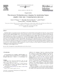 Non-Invasive Bioluminescence Imaging for Monitoring Herpes Simplex Virus Type 1 Hematogenous Infection