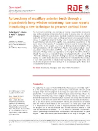 Apicoectomy of Maxillary Anterior Teeth Through a Piezoelectric Bony-Window Osteotomy: Two Case Reports Introducing a New Technique to Preserve Cortical Bone