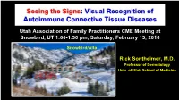 Visual Recognition of Autoimmune Connective Tissue Diseases