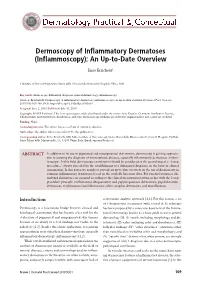 Dermoscopy of Inflammatory Dermatoses (Inflammoscopy): an Up-To-Date Overview