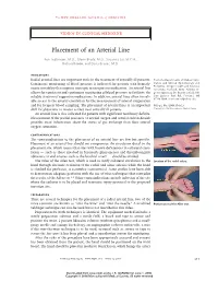 Placement of an Arterial Line