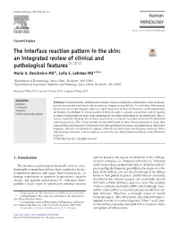 The Interface Reaction Pattern in the Skin: an Integrated Review of Clinical and Pathological Features☆,☆☆ Maria A