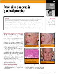 Rare Skin Cancers in General Practice