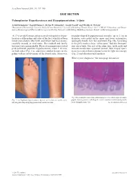 QUIZ SECTION Palmoplantar Hyperkeratoses And