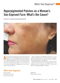 Hyperpigmented Patches on a Woman's Sun-Exposed Face