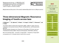 Fossil MRI D