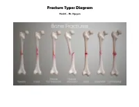 Fracture Types Diagram