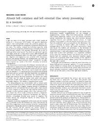 Absent Left Common and Left External Iliac Artery Presenting in a Neonate