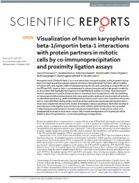 Visualization of Human Karyopherin Beta-1/Importin Beta-1 Interactions