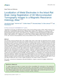 Localization of Metal Electrodes in the Intact Rat Brain Using Registration of 3D Microcomputed Tomography Images to a Magnetic Resonance Histology Atlas1,2,3