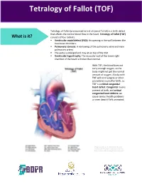 Tetralogy of Fallot (TOF)