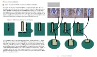 Placket Construction Options
