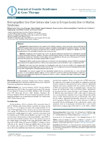 Retropupillary Iris-Claw Intraocular Lens in Ectopia Lentis Due To