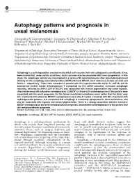 Autophagy Patterns and Prognosis in Uveal Melanomas