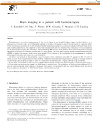 Brain Imaging in a Patient with Hemimicropsia
