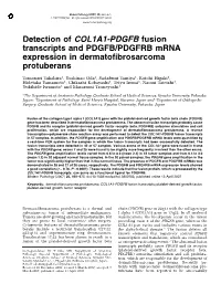 Detection of COL1A1-PDGFB Fusion Transcripts and PDGFB/PDGFRB Mrna Expression in Dermatofibrosarcoma Protuberans