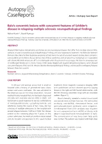 Balo's Concentric Lesions with Concurrent Features of Schilder's