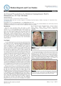 An Unusual Presentation of a Unilateral Asymptomatic Riehl's