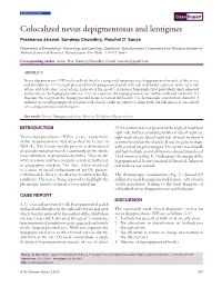 Colocalized Nevus Depigmentosus and Lentigines Prashansa Jaiswal, Sundeep Chowdhry, Paschal D’ Souza