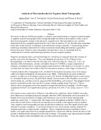 Analysis of Macromolecules by Negative Stain Tomography