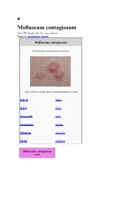 Molluscum Contagiosum from Wikipedia, the Free Encyclopedia Jump To: Navigation, Search