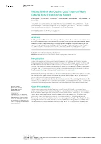 Hiding Within the Cracks: Case Report of Rare Sutural Bone Found at the Nasion