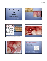 Bone Grafting for Socket Preservation